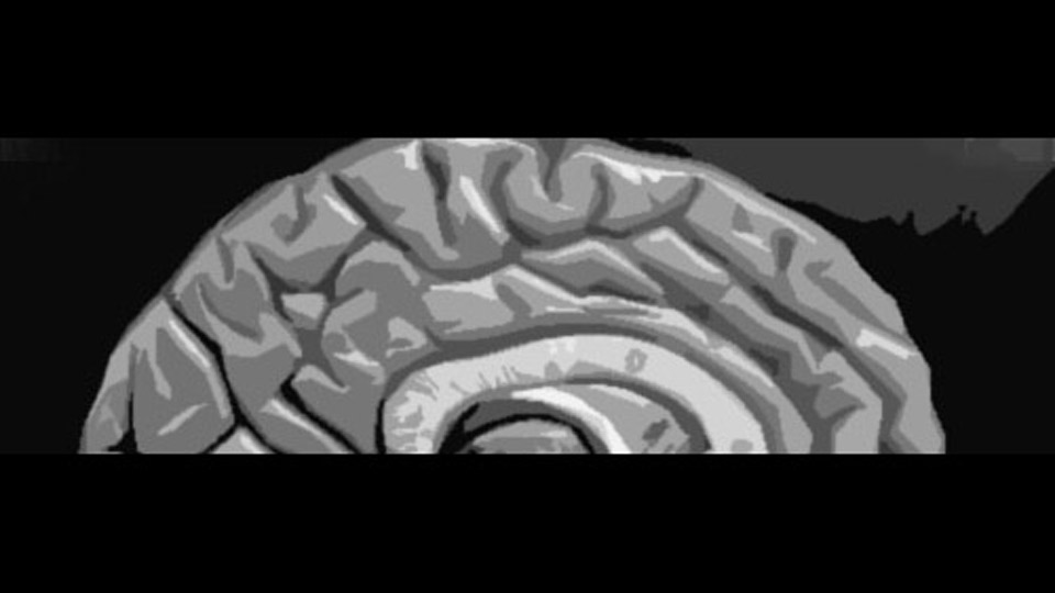 第38夜：脳を盗まれた女